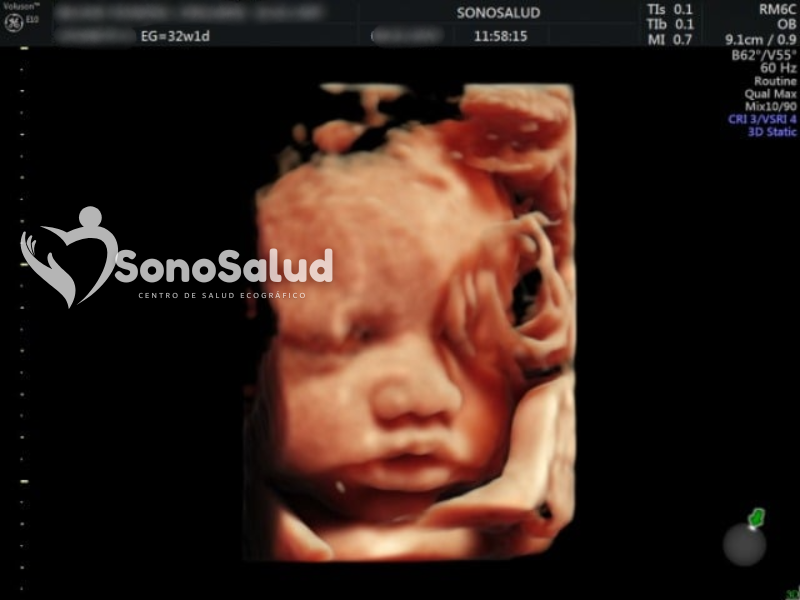 Promo 3D/5D Sonosalud