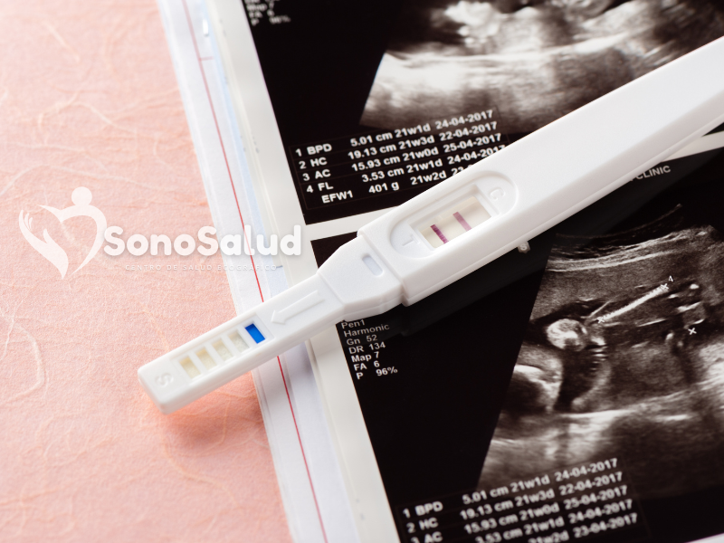 Confirmación de Embarazo