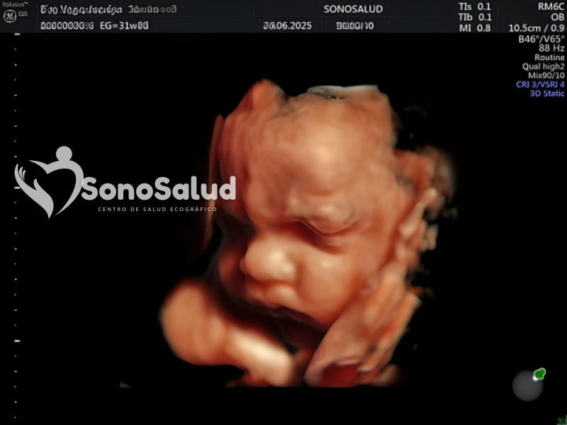 Ecografía 5D Full