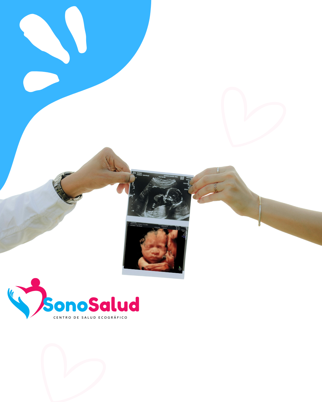 Centro de Ecografías en Providencia para chilenos y extranjeros con DNI o Pasaporte - SonoSalud